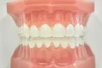 マウスピース型矯正装置