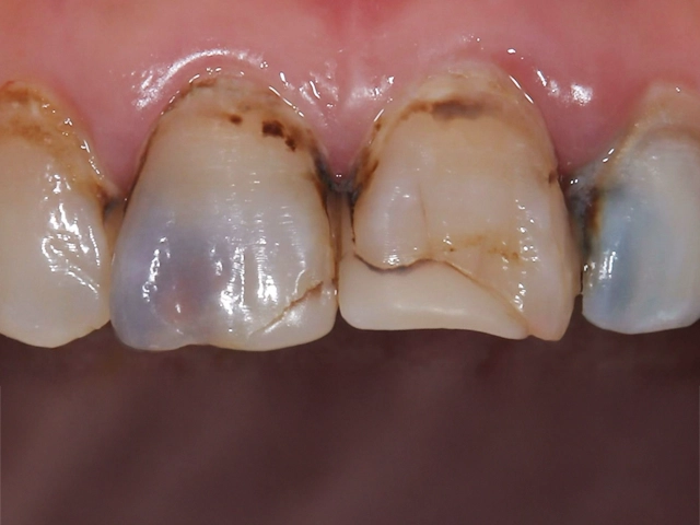 形が整っていない前歯