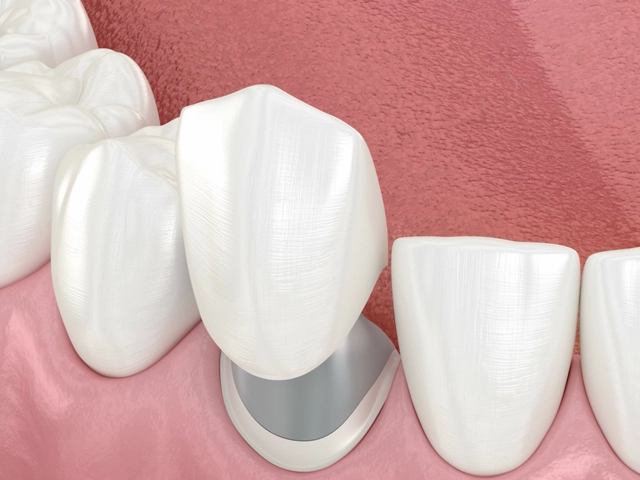セラミッククラウンのイメージ