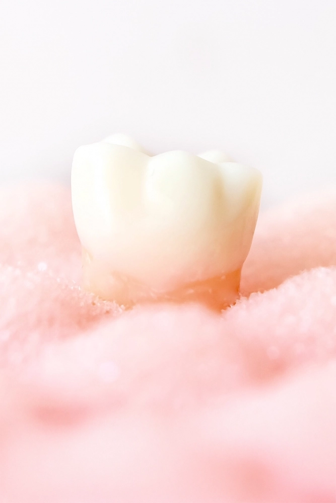 根面が露出した歯のイメージ