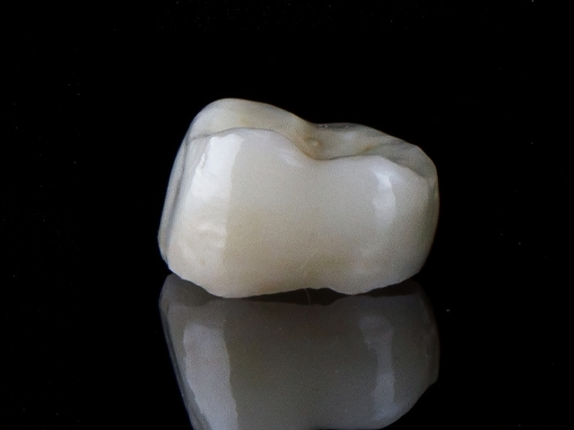 ジルコニアの被せ物