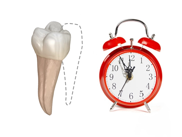 ヘミセクションで分割された歯と寿命を示す時計